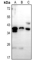 1 - Anti-PTGR1 Antibody AP61338