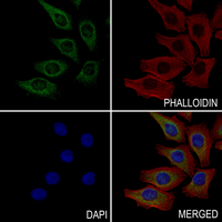 3 - Anti-ME1 Antibody AP61339