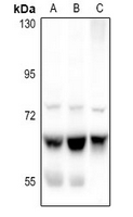 1 - Anti-ME1 Antibody AP61339