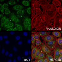 3 - Anti-ARHGEF11 Antibody AP61342