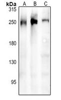 1 - Anti-ARHGEF11 Antibody AP61342