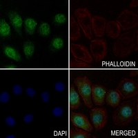 3 - Anti-Spinophilin Antibody AP61345