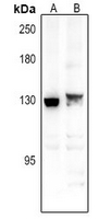 1 - Anti-Spinophilin Antibody AP61345