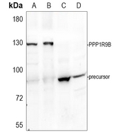 0 - Anti-Spinophilin Antibody AP61345
