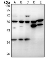 1 - Anti-CD215 Antibody AP61346