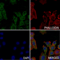 3 - Anti-Podocan Antibody AP61347
