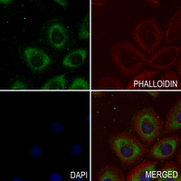 3 - Anti-Alpha-internexin Antibody AP61348