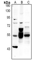 1 - Anti-Alpha-internexin Antibody AP61348