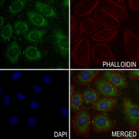 3 - Anti-ITIHC4 Antibody AP61349