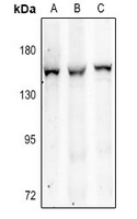 1 - Anti-ITIHC4 Antibody AP61349