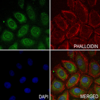 3 - Anti-Factor XI HC Antibody AP61350