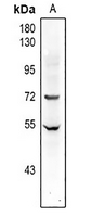 1 - Anti-Factor XI HC Antibody AP61350