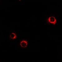 3 - Anti-5-HT5A Antibody AP61351