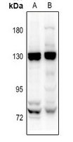 0 - Anti-EMR1 Antibody AP61352