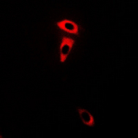 3 - Anti-Frizzled 3 Antibody AP61354