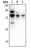 1 - Anti-Frizzled 3 Antibody AP61354