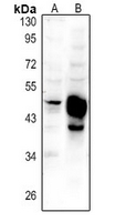 1 - Anti-GPR150 Antibody AP61355