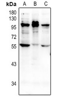 1 - Anti-NMBR Antibody AP61356