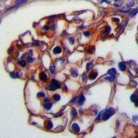 19 - Anti-RRH Antibody AP61357