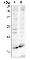 1 - Anti-RRH Antibody AP61357