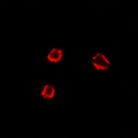 3 - Anti-TRHR Antibody AP61359