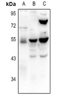 1 - Anti-TRHR Antibody AP61359