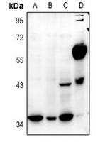 1 - Anti-E2F5 Antibody AP61360