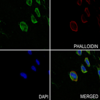 3 - Anti-CD125 Antibody AP61361