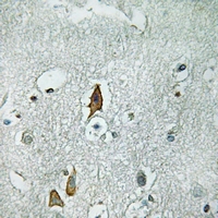 19 - Anti-CD125 Antibody AP61361
