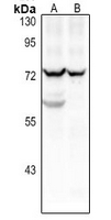 1 - Anti-CD125 Antibody AP61361