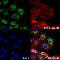 3 - Anti-CD103 Antibody AP61364