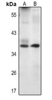 1 - Anti-Livin Antibody AP61365