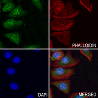3 - Anti-Histidine Decarboxylase Antibody AP61367
