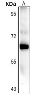 1 - Anti-CARM1 Antibody AP61368