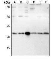 1 - Anti-IFN beta Antibody AP61370