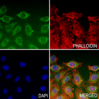 3 - Anti-BACE1 (Acetyl-K316) Antibody AP61373