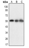 1 - Anti-BACE1 (Acetyl-K316) Antibody AP61373