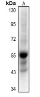 1 - Anti-Histone Deacetylase 1 (Acetyl-K220) Antibody AP61374