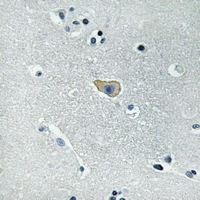 19 - Anti-NMDAR1 (Phospho-S890) Antibody AP61377
