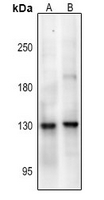 1 - Anti-NMDAR1 (Phospho-S890) Antibody AP61377