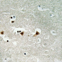 19 - Anti-DNA-PKcs (Phospho-S2612) Antibody AP61380