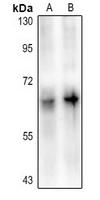 1 - Anti-DAB1 (Phospho-Y220) Antibody AP61381