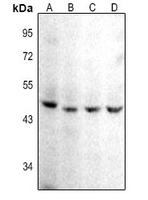 1 - Anti-CD142 Antibody AP61382