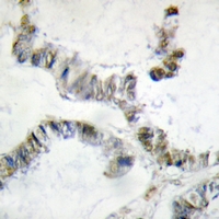 19 - Anti-HMGXB3 Antibody AP61385