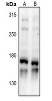 1 - Anti-HMGXB3 Antibody AP61385