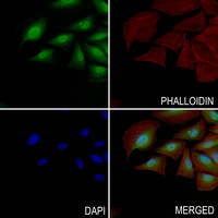 3 - Anti-DGK zeta Antibody AP61386