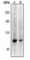 1 - Anti-DGK zeta Antibody AP61386