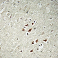19 - Anti-ABHD14B Antibody AP61387