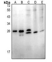 1 - Anti-ABHD14B Antibody AP61387