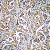 19 - Anti-ADAMTS17 Antibody AP61388
